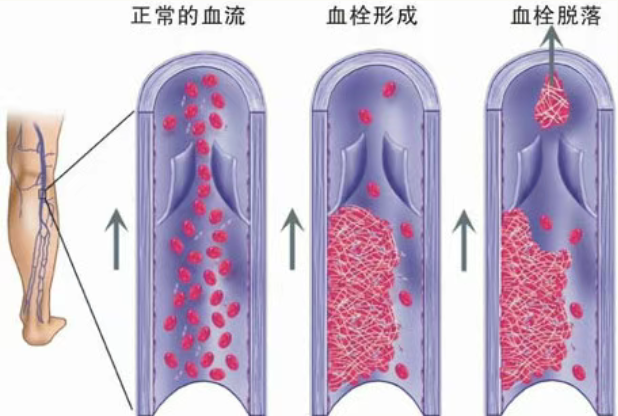 1758246220161668.png image.png